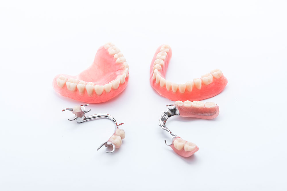 https://www.selarl-dentaire-ponthieu-chirurgiens-dentistes.fr/wp-content/uploads/prothese-adjointe.jpeg